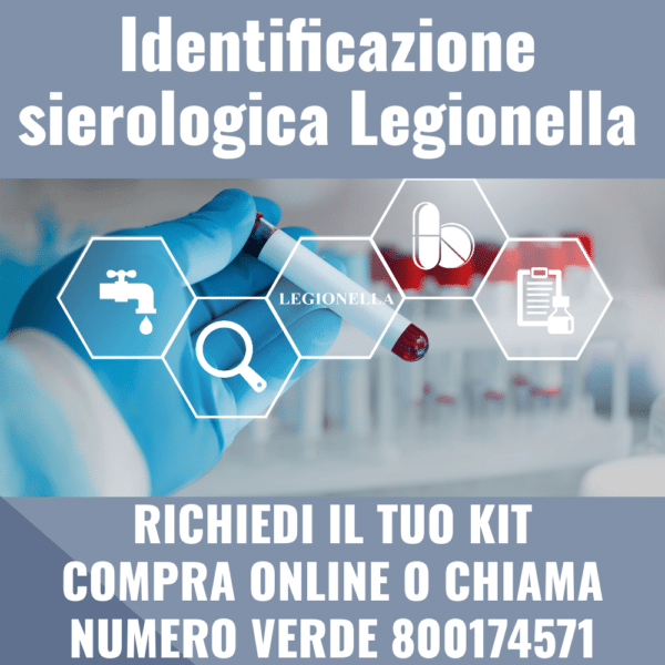 Identificazione sierologica Legionella