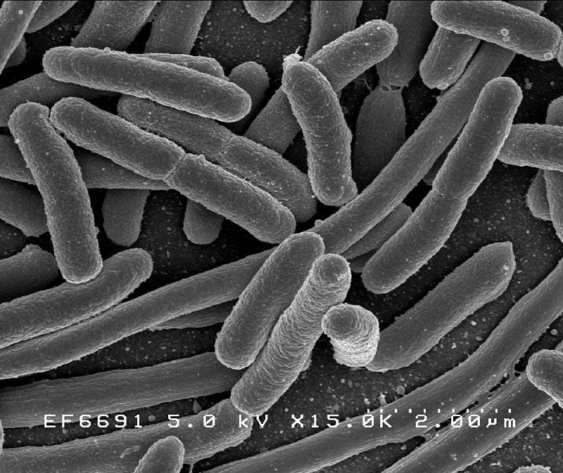 Escherichia Coli: Come Proteggere la Tua Famiglia dalla Contaminazione