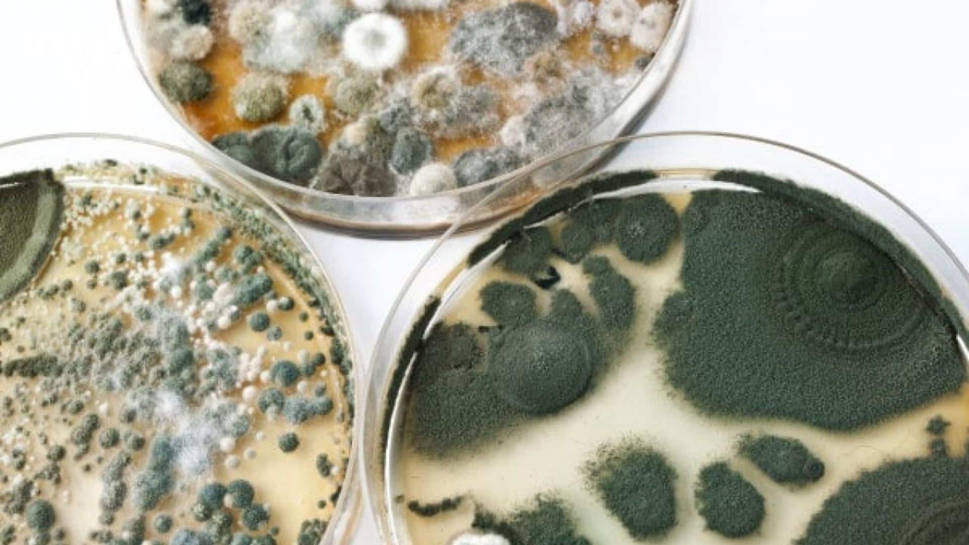 Muffe e Lieviti: Come Analizzarli nel Laboratorio di Microbiologia